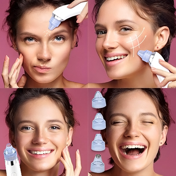 Efektet e ringjalljes së lëkurës nga KILPOR 2.0